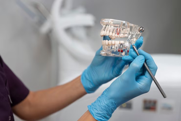 How Painful Is a Root Canal? Debunking the Myths